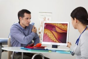 A picture of a doctor wearing a stethoscope around her neck showing a patient an up-close image of the coronary arteries. 