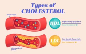 An Illustration Titled “Types of Cholesterol” Showing Two Types of Cholesterol Labeled “HDL” and “LDL”